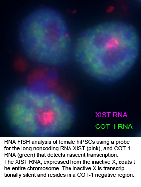 XIST FISH, Anguera Lab, Penn Vet