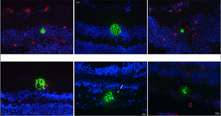 T gondii in the retina, Hunter Lab