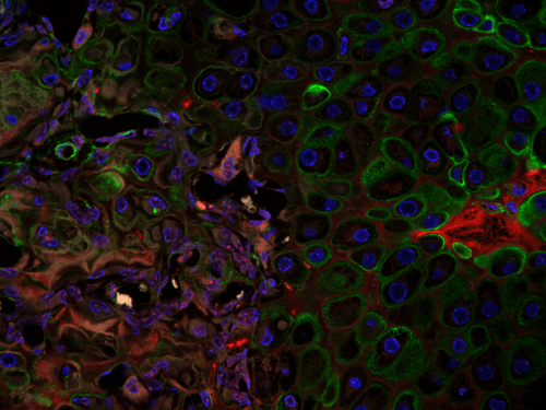 extracellular-matrix-protein